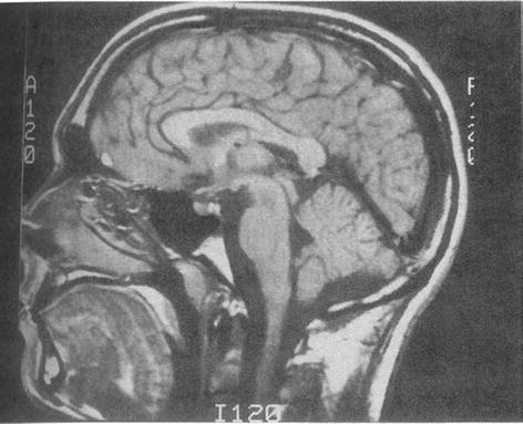 /epubstore/E/M-S-Ellison/Child-Neuropsychology/OEBPS/A978-0-387-88963-4_2_Fig4_HTML.jpg