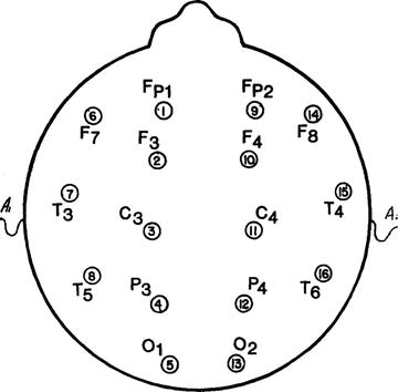 /epubstore/E/M-S-Ellison/Child-Neuropsychology/OEBPS/A978-0-387-88963-4_4_Fig1_HTML.jpg