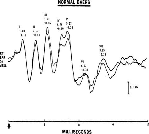 /epubstore/E/M-S-Ellison/Child-Neuropsychology/OEBPS/A978-0-387-88963-4_4_Fig2_HTML.jpg