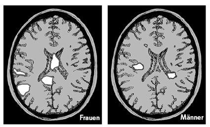 Pease-Warum_Maenner_img_58.jpg