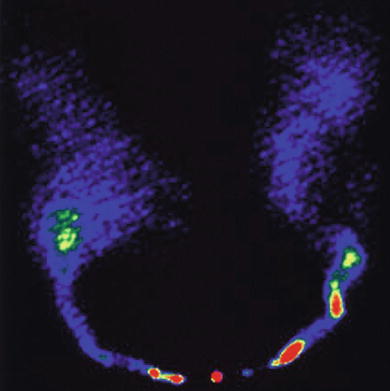 /epubstore/S/P-Schneider/Extragalactic-Astronomy-And-Cosmology/OEBPS/A129044_2_En_6_Fig33_HTML.jpg